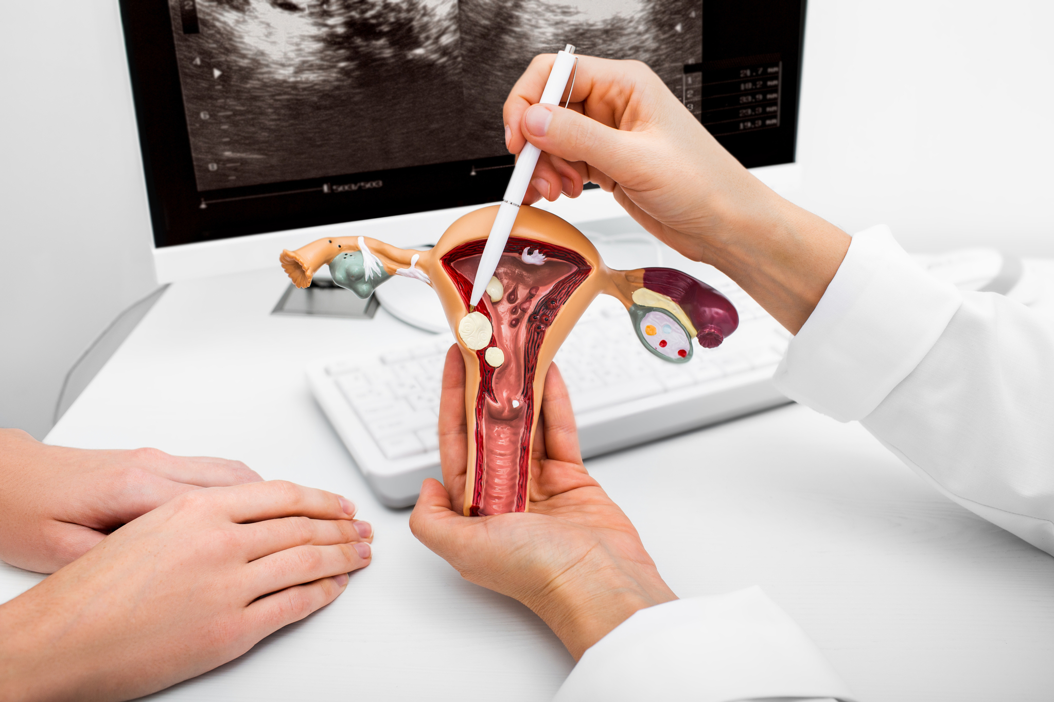 Penyakit Tanpa Simptom Fibroid Dan Cyst – Apa Yang Perlu Wanita Tahu?
